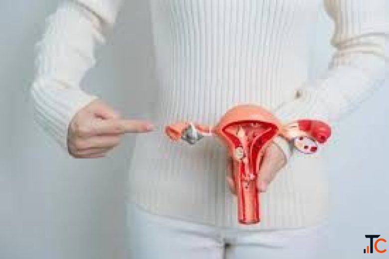 Fibroid Prevention Tips Understanding Uterine Fibroids