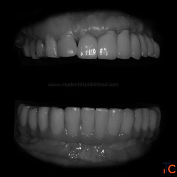 Best Dental Doctor in Kerala Your Guide to Healthy Teeth and a Confident Smile