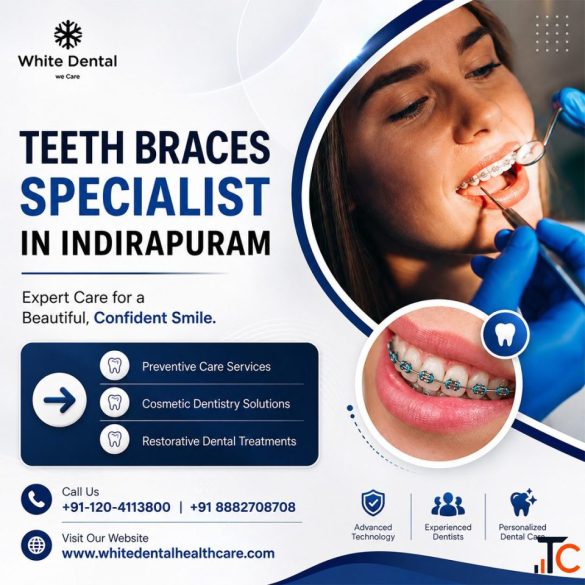 Teeth Braces Specialist in Indirapuram for Perfect Smiles