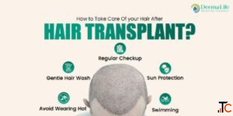 Hair Transplant Cost in Delhi 2026 Price Grafts FUE