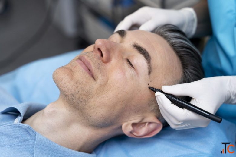 Eyebrow Transplant Cost India Know the Price Get Natural Brows Ayushman Hair Centre