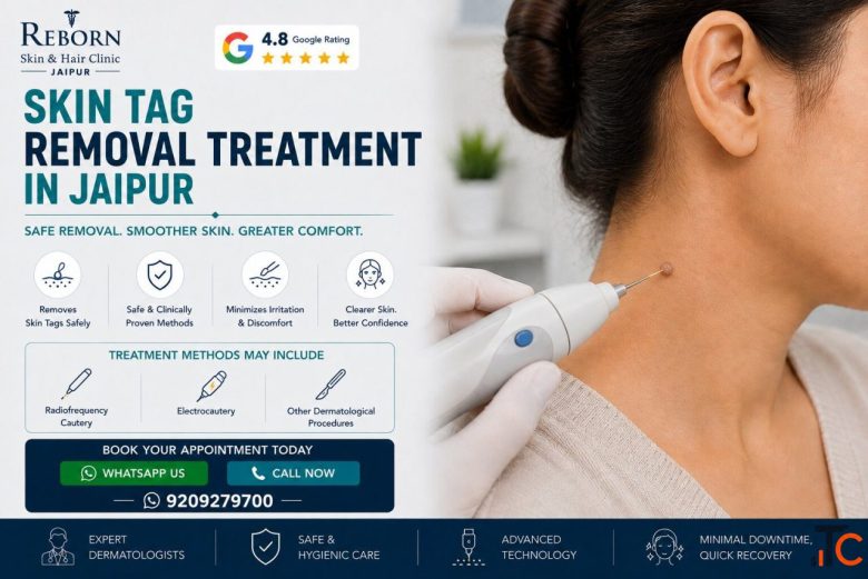 Skin Tag Removal Treatment in Jaipur for Eyelid Neck Growths