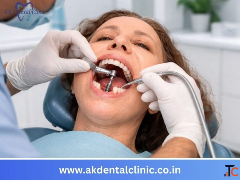 72-Hour Full-Mouth Dental Implants in Mumbai AK Dental Clinic