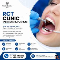 RCT Clinic in Indirapuram for Root Canal Care