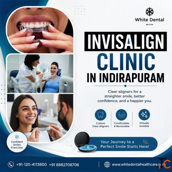 Invisalign Clinic in Indirapuram for Modern Orthodontics