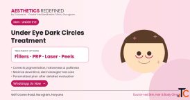 Under Eye Dark Circles Treatment in Gurgaon Aesthetics Redefined by Cocoona