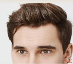 Groom's Guide to Wedding-Ready Skin Aesthetic Prep Timeline