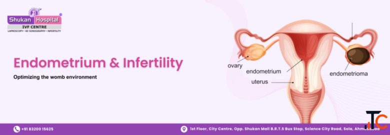Endometriosis Treatment in Ahmedabad