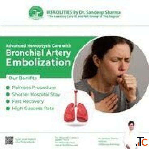 Bronchial Artery Embolization Radiology State-of-the-Art Hemoptysis Management