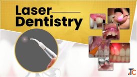 Scared of the Dentist Try Painless Laser Dental Treatment