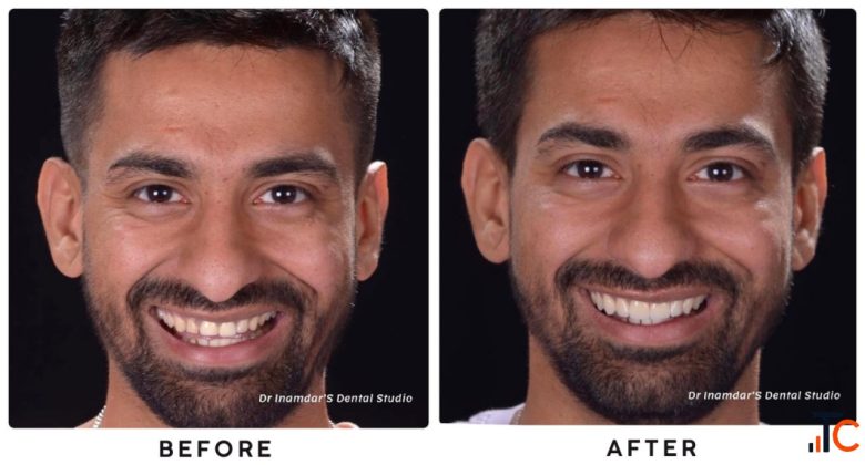 Dentist in Mumbai Redefining Smiles with Digital Precision