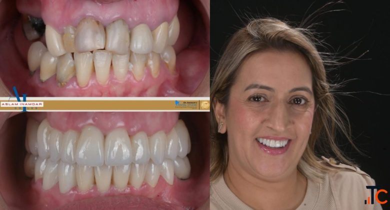 Dentist in Mumbai Redefining Smiles with Digital Precision