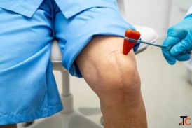 Best Knee Replacement Surgery in Gandhinagar - Advanced Hospital