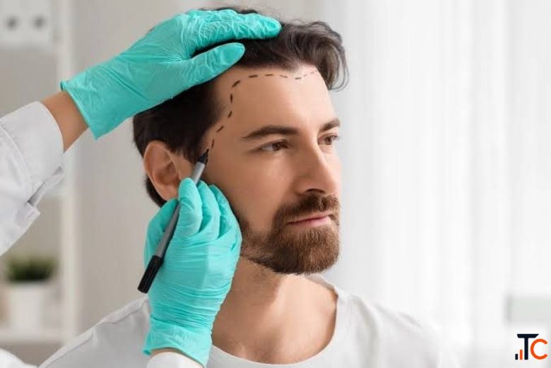 India's Premier Hair Transplant Clinic Trusted by Thousands