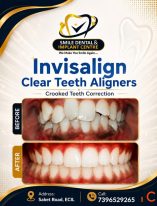 INVISALIGN CLEAR ALIGNERS at Smile Dental Implant Centre