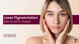 Laser Pigmentation Removal in Dubai UAE