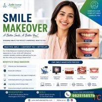 Smile Makeover Treatment in Ahmadabad DR. Manish Shah