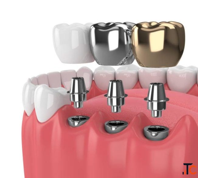 Dental Clinic in Madurai