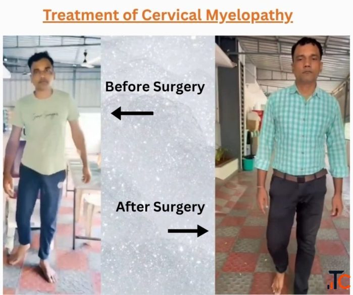 Spinal Trauma Treatment by Dr. B. Leela Prasad Amulya Hospital