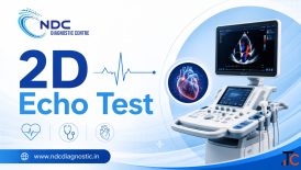 2D Echo Test For Accurate Heart Assessment