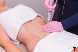 Does VASER Liposuction Actually Tighten Skin