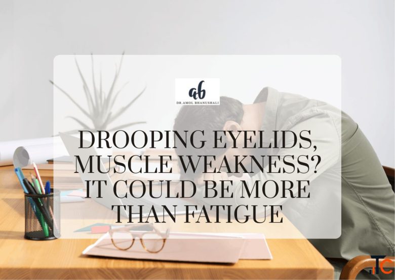 Drooping Eyelids Muscle Weakness It Could Be More Than Fatigue