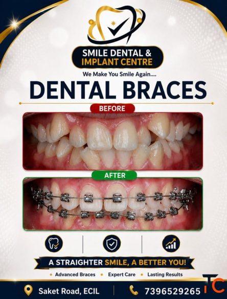 Get a Straighter Smile with Advanced Dental Braces