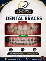 Get a Straighter Smile with Advanced Dental Braces