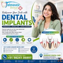 Best Dental Implants Clinic in Ahmadabad - Jahnavee Dental Care