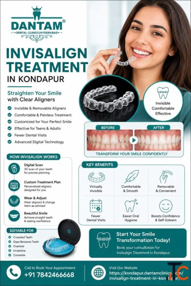Do Your Teeth Need Invisalign Signs You May Need Invisalign Treatment in Kondapur