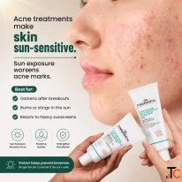 Top Picks Sunscreens That Actually Work for Oily Skin