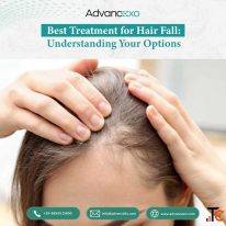 Best Treatment for Hair Fall Understanding Your Options