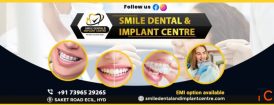 Looking for a Top Dentist Near AS Rao Nagar ECIL