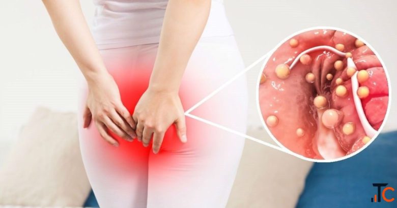 Ayurvedic Care for Piles and Fistula with Expert Guidance