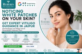 Vitiligo Treatment for White Spots on Skin near Tilak Nagar Jaipur