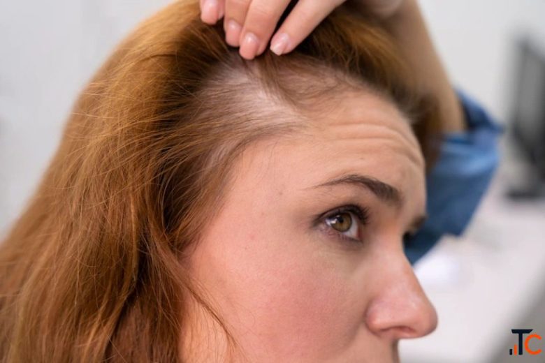 Struggling with Hair Loss Meet Mumbai's Leading Hair Specialist Today