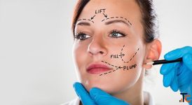 Facelift Surgery Cost In Delhi - Dr Rajat Gupta