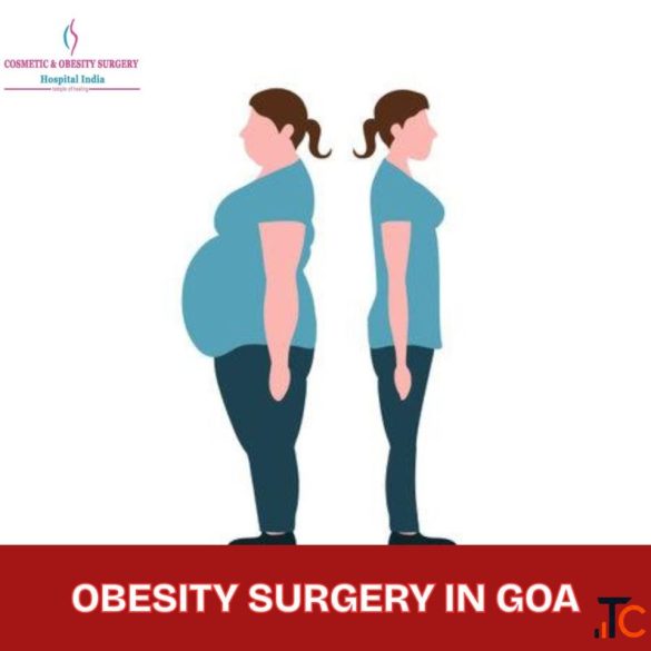 Top Obesity Surgery Hosptials in Goa