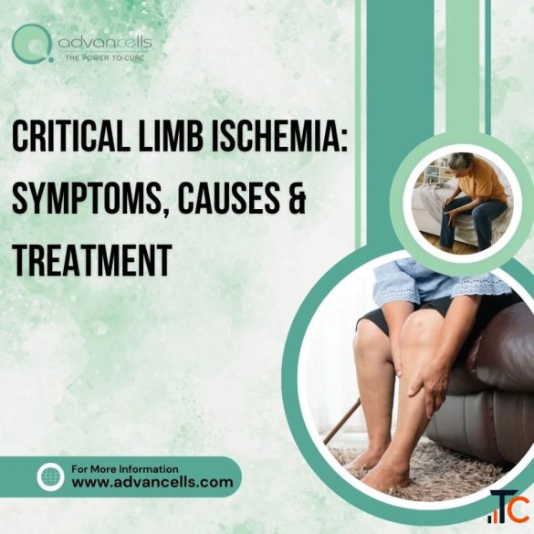 Critical Limb Ischemia Symptoms Causes and Treatment