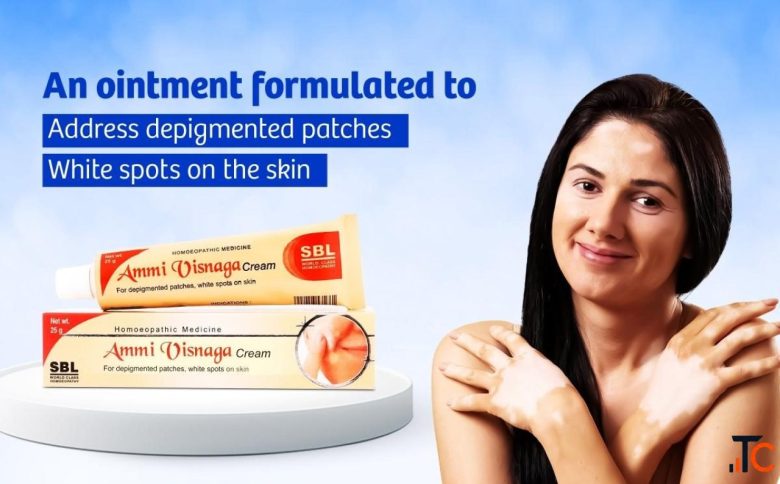 White Spots on Skin Homeopathy Treatment - Support Your Skin Naturally