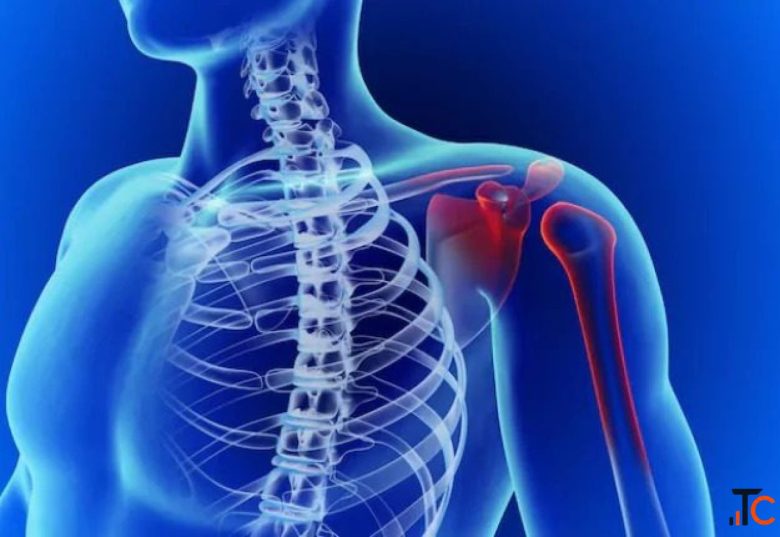 Advanced Treatment for Shoulder Dislocation Dr. Rajat Jangir