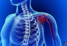 Advanced Treatment for Shoulder Dislocation Dr. Rajat Jangir