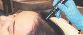 Best Hair Specialist in Thrissur How to Choose the Right Expert for Your Hair Concerns