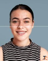 Skin and Hair Clinic Thrissur Complete Guide to Professional Skin and Hair Care