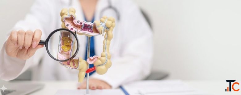 Intestinal Cancer Treatment in Delhi