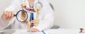Intestinal Cancer Treatment in Delhi