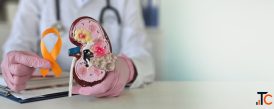 Kidney Cancer Treatment in Delhi